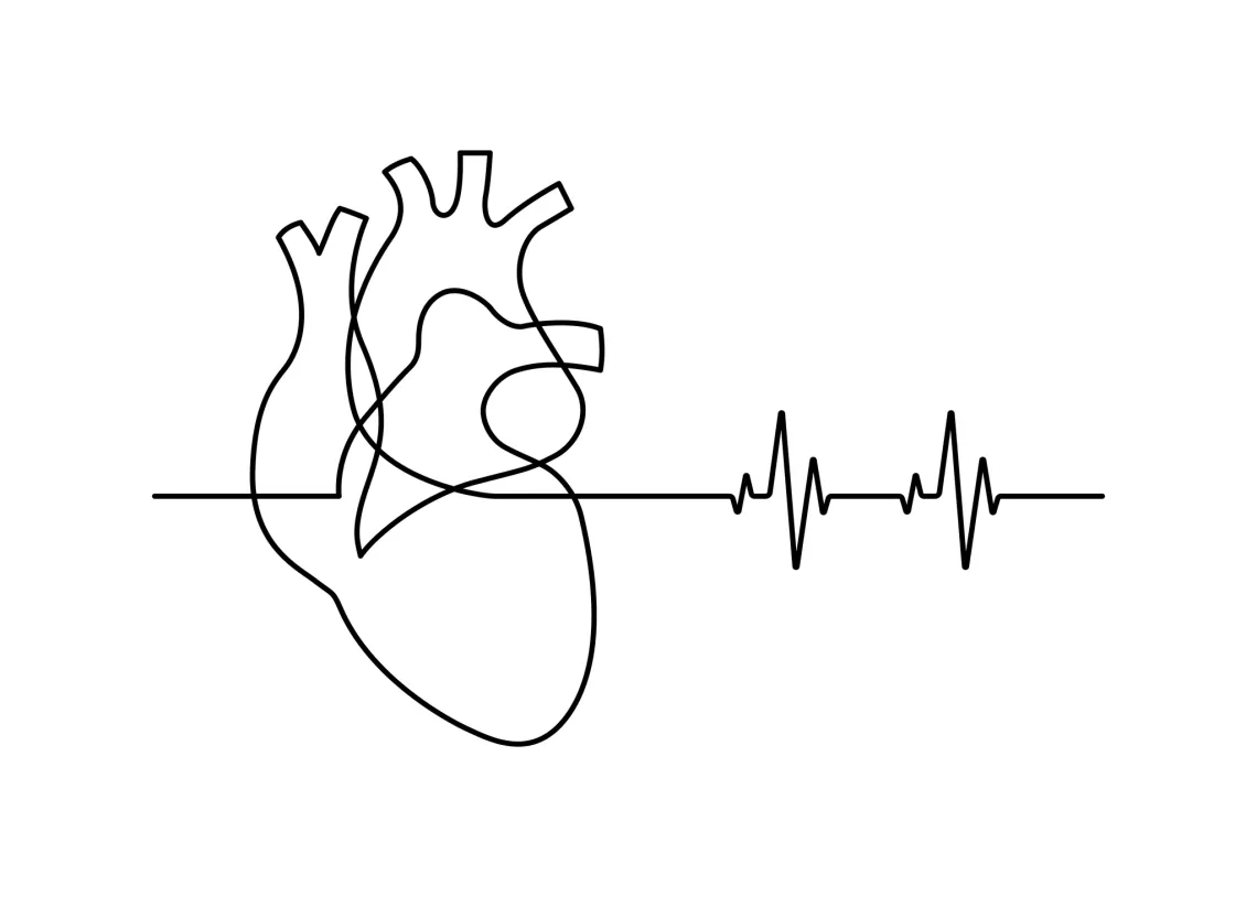 cardiac rehab
